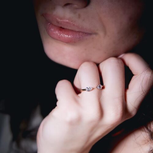 Anello Comete