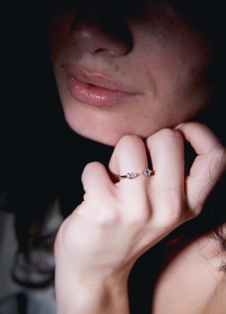 Anello Comete